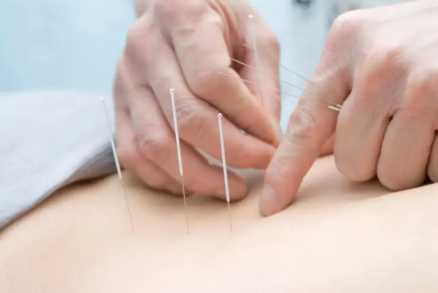 Boost Your Energy & Immunity with Acupuncture Service in Scarborough, ON