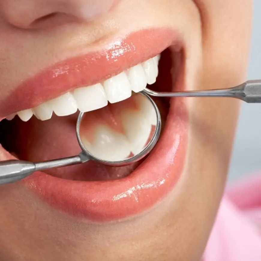 Teeth Fillings: The Path to Stronger Smiles