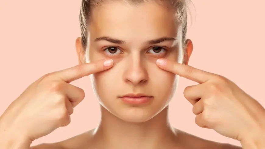 Which Dark Circles Treatment Works Permanently?