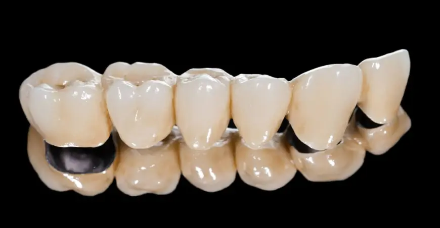 The Role of Zirconia Crowns in Smile Makeovers