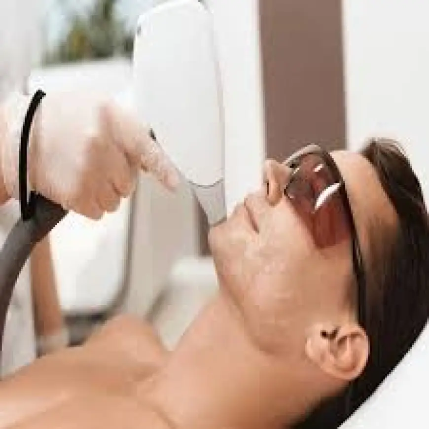 Laser Hair Removal in Islamabad – Smooth Skin Made Easy
