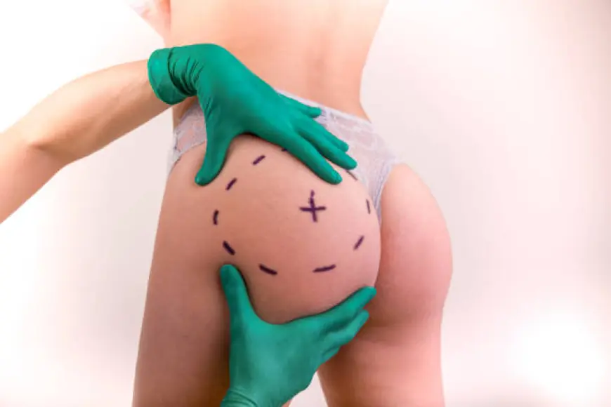 Brazilian Butt Lift in Dubai: A Path to Glamorous Curves