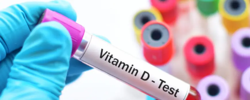 Vitamin D Test Price - Cost, Purpose, Procedure & Importance