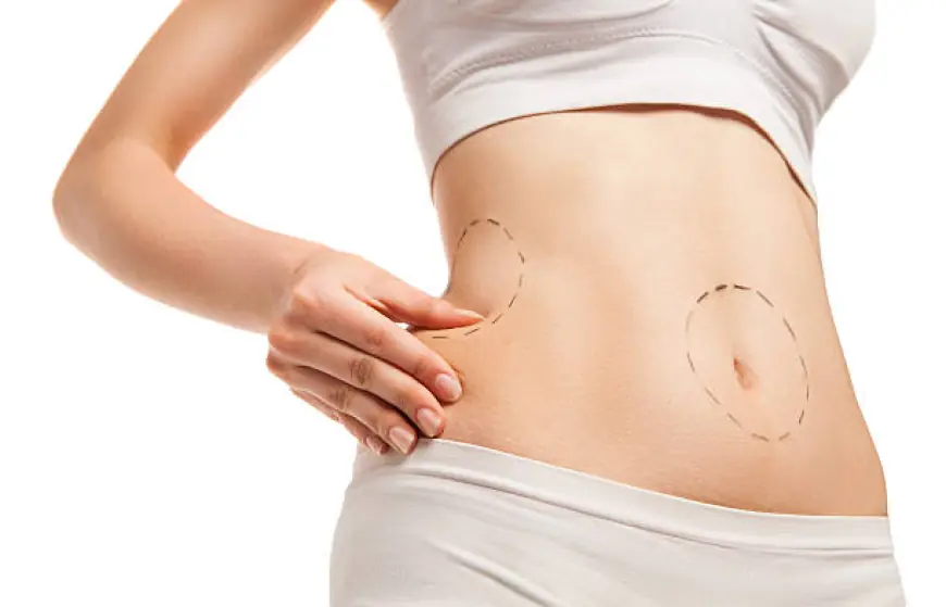 Latest Advances in Liposuction Technology Now in Riyadh