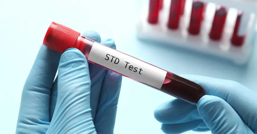STD Test in Dubai: Understanding Window Periods and Accuracy