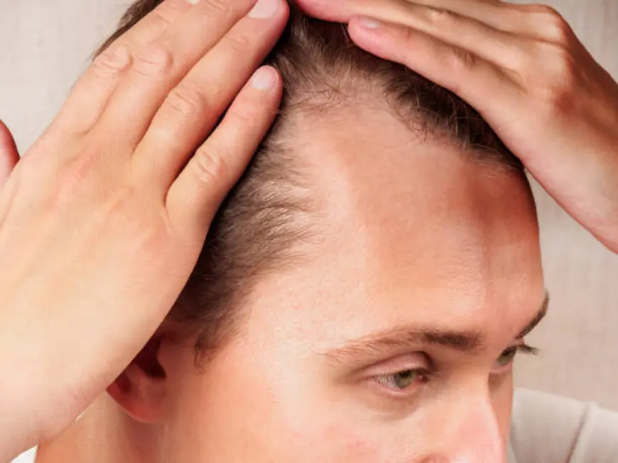 أفضل الأطباء لزراعة الشعر في الرياض