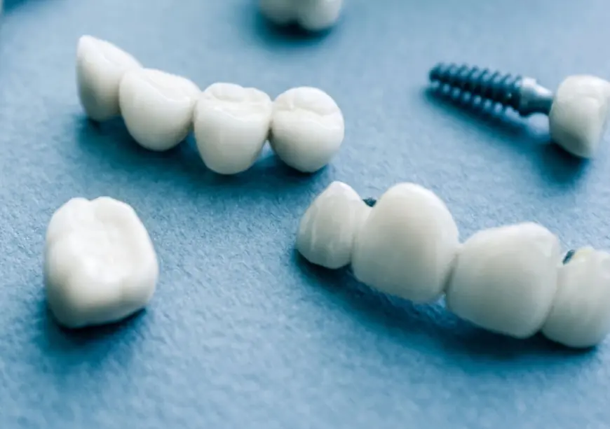 Zirconia Crowns vs. Ceramic Crowns: A Comparative Guide