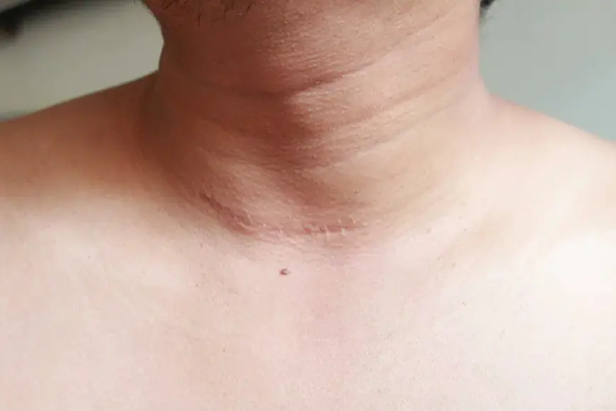 Discover Clarity with Surgical Scar Revision