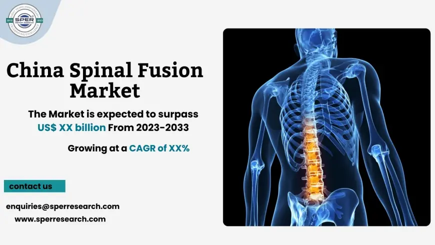 China Spinal Fusion Market Growth, Size, Trends, Revenue 2033
