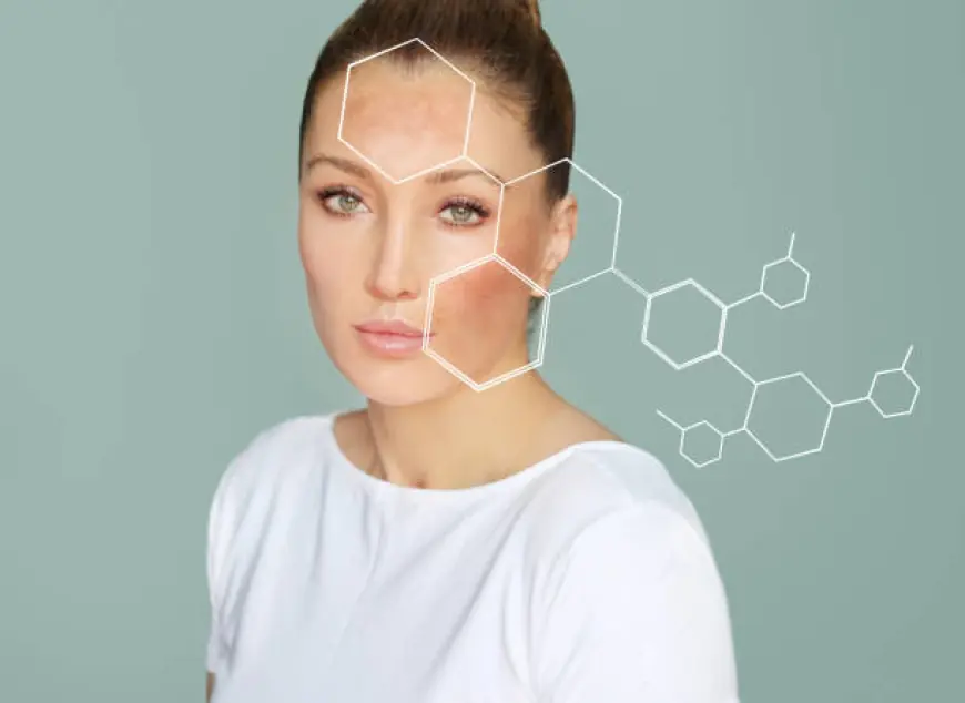 Why Chemical Peels in Dubai Are the Secret to Flawless Skin