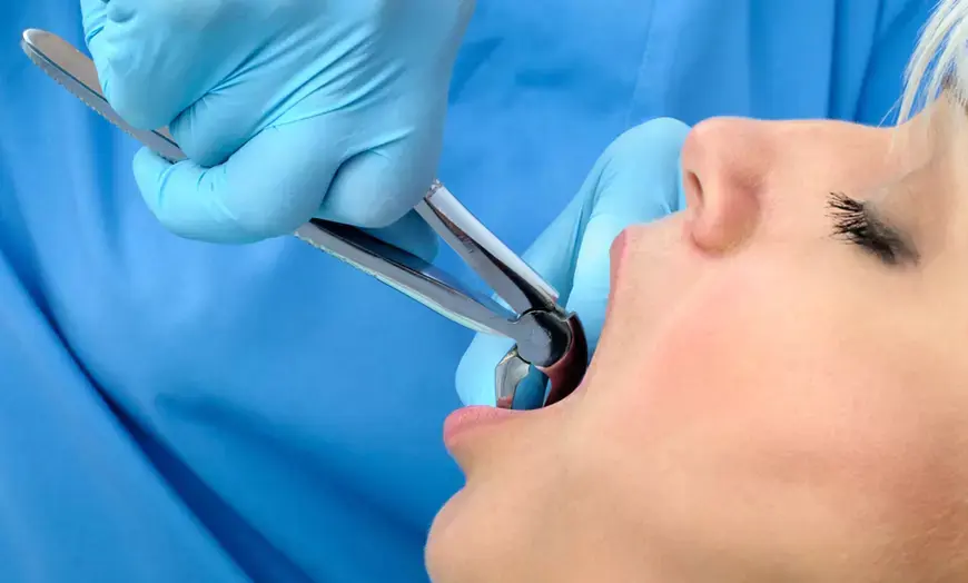 Tooth Removal and Infection Risks: What Patients Should Know