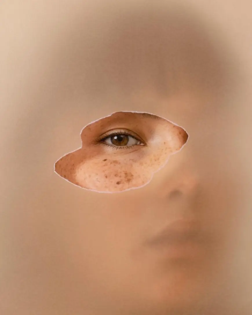 The Benefits of Eyelid Surgery in Riyadh: Enhancing Appearance and Confidence