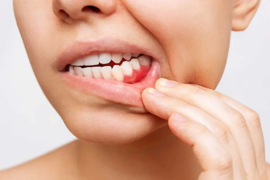 The Dual Threat: Understanding the Types of Gum Disease and the Role of an Emergency Dentist in Houston