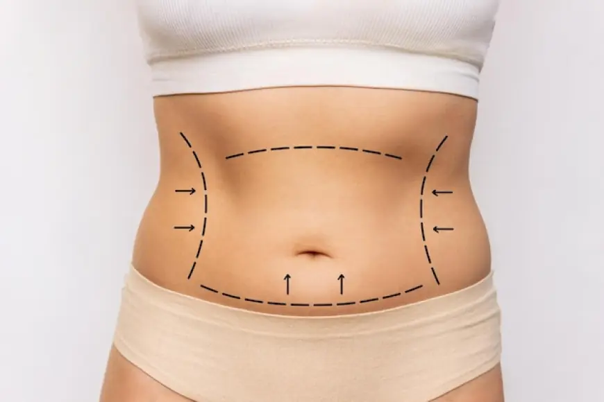 Liposuction in Dubai Shapes Timeless Style Into Modern Confidence