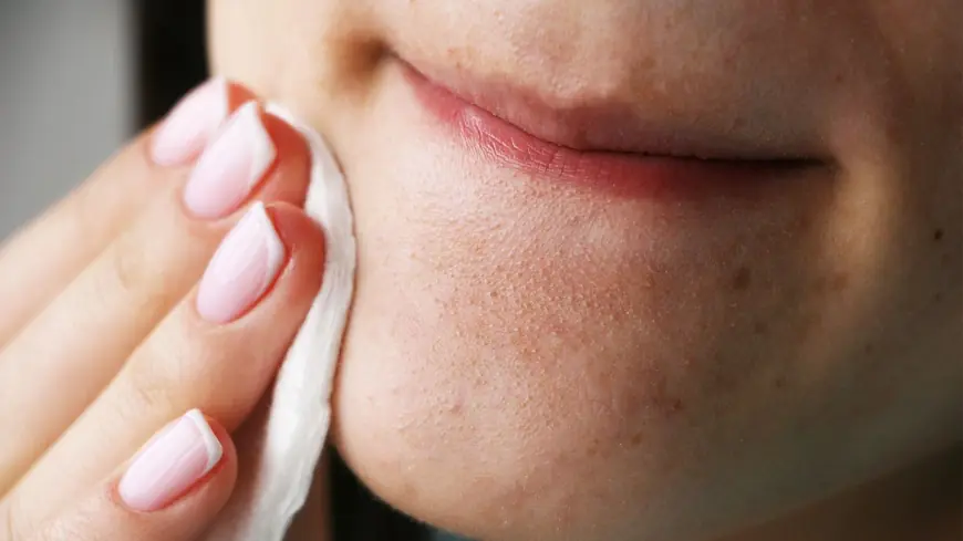 Which Acne Treatment Removes Blackheads Quickly?
