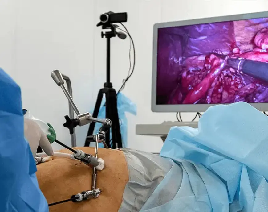 Can Laparoscopic Surgery Be Done On Overweight Patients?