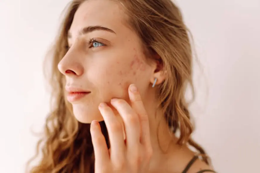 Best Dermatologist in Dubai for Hair Loss and Scalp Treatments