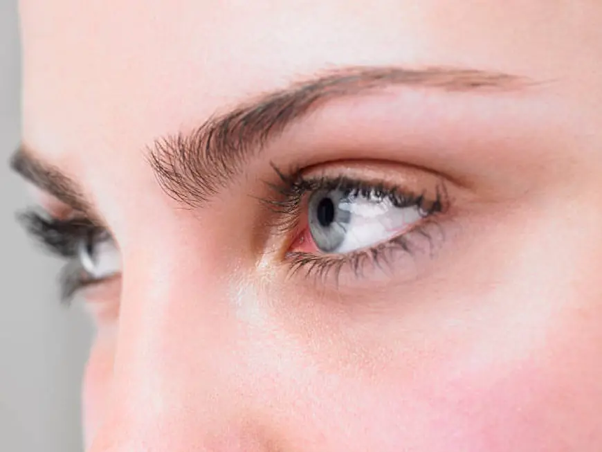 Eyelid Surgery: Who Is the Ideal Candidate?