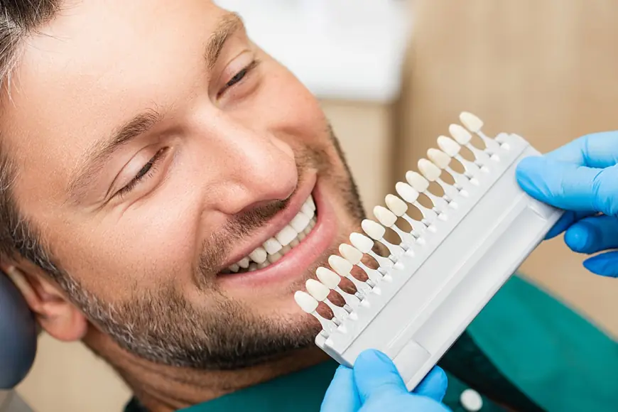 In London, Ontario, Veneers Can Change Your Smile