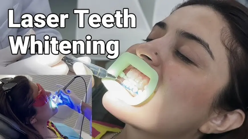 Affordable Teeth Whitening in Islamabad – Get a Sparkling Smile