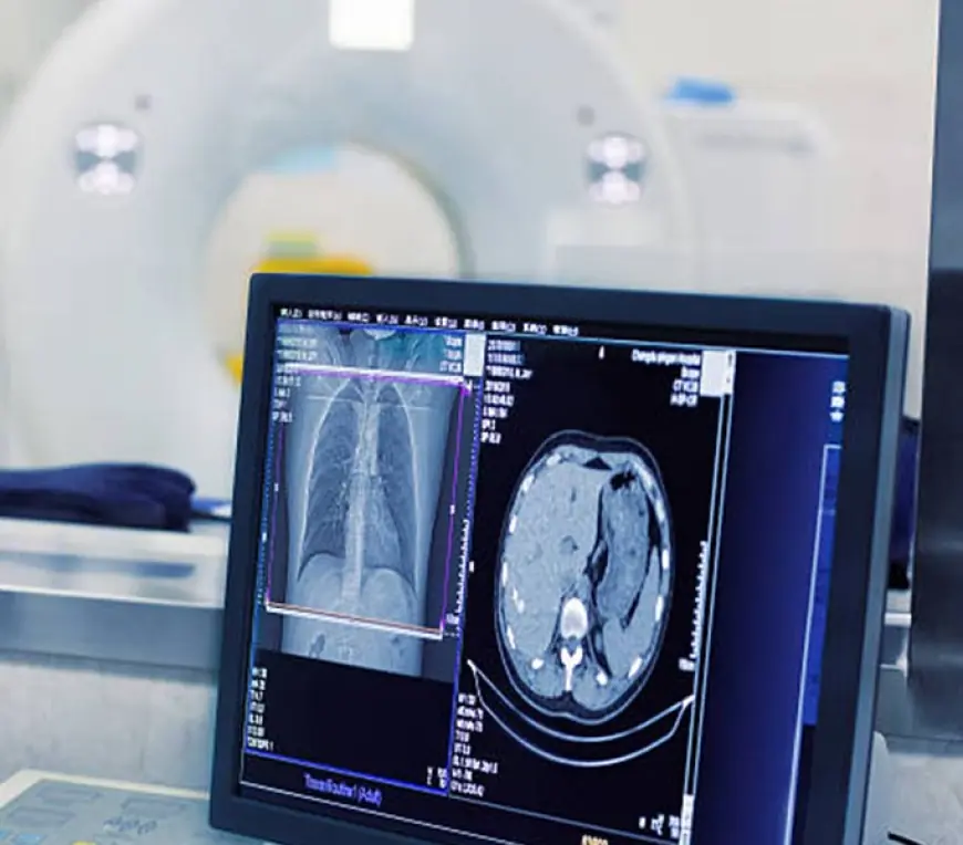 Advanced Digital Chiropractic X-ray Care