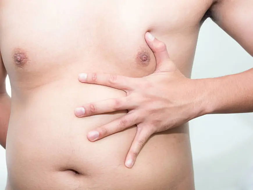 Gynecomastia Surgery in Riyadh: Step-by-Step Guide to the Procedure