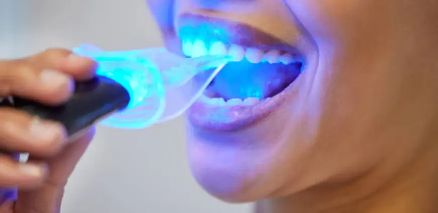 Is Zoom Teeth Whitening in Dubai Right for You?