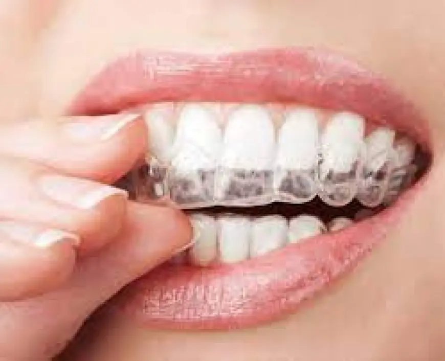 Affordable Orthodontic Packages – Crowded Teeth Treatment in Islamabad