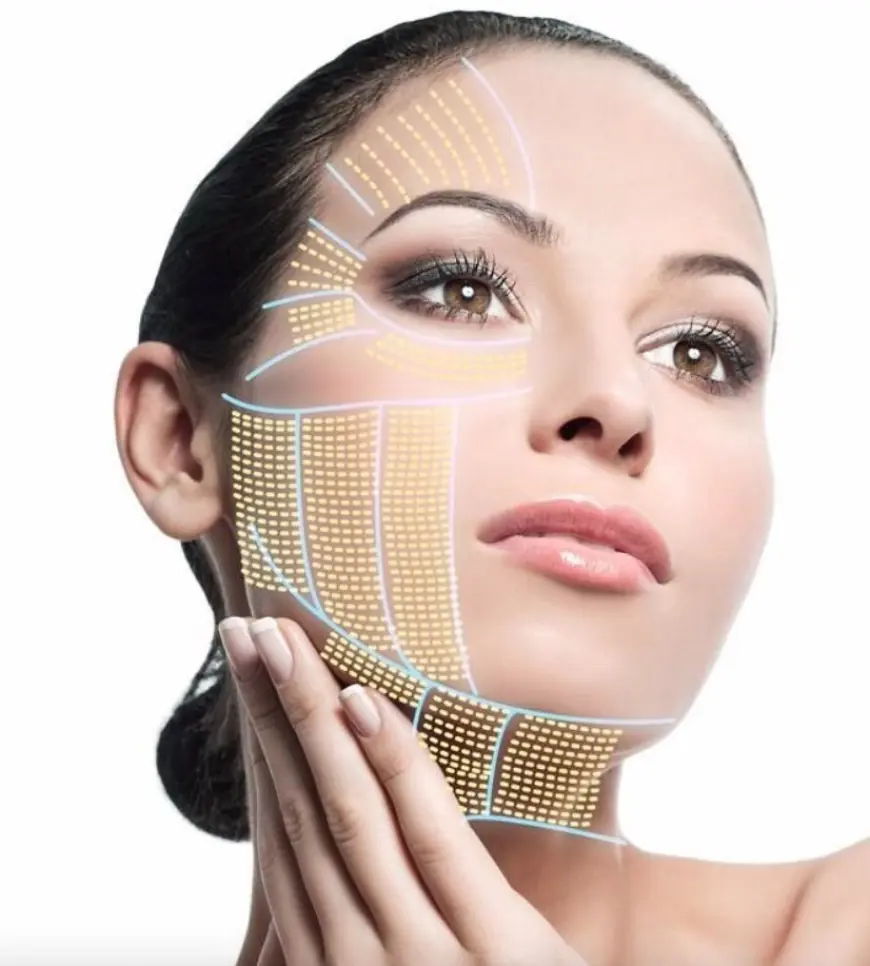 Does HIFU Help With Acne Scars and Skin Texture?