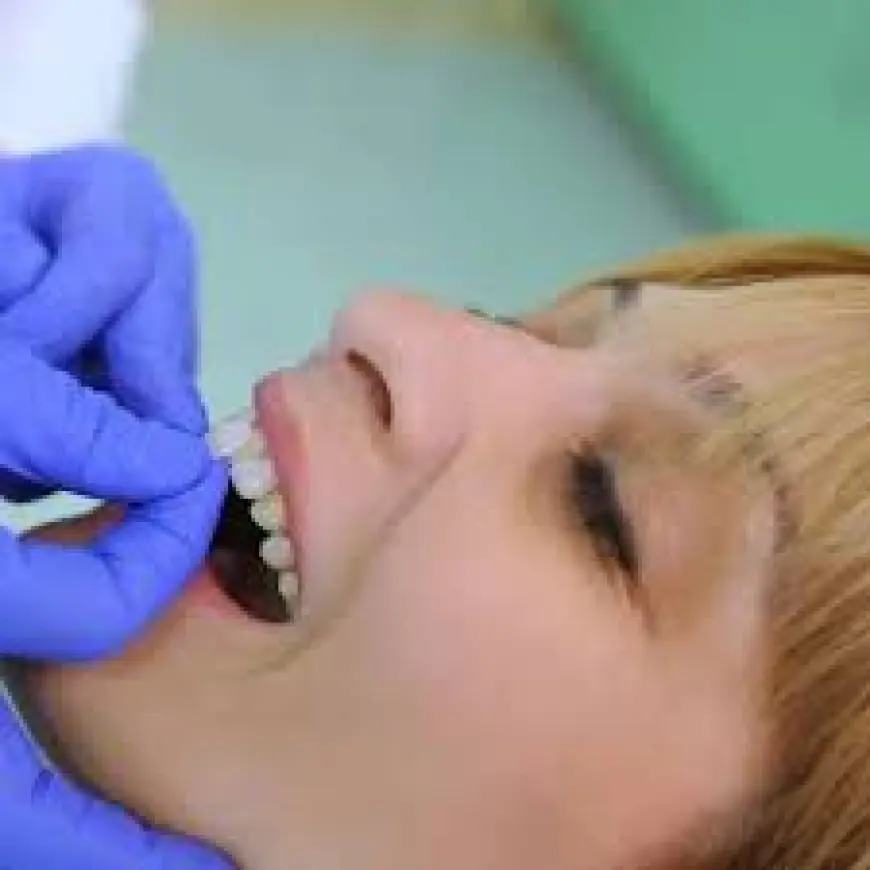 Dental Veneers in Islamabad – Get a Perfect Hollywood Smile