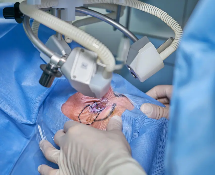 Top LASIK Surgery in Chennai – Trusted Hospitals & Treatment Costs