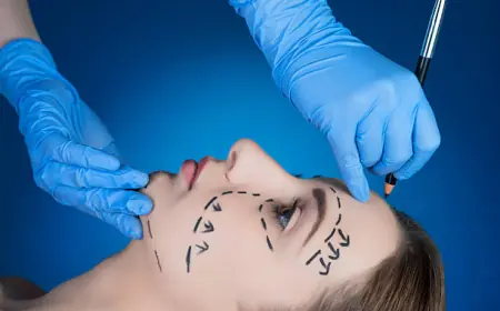 Insider Tips for Choosing the Right Facelift Surgeon in Riyadh