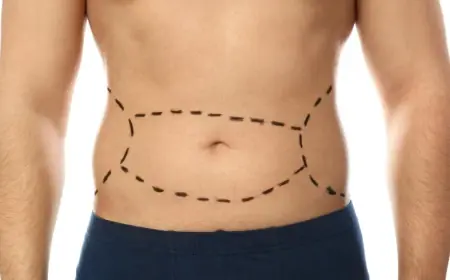 Does a Tummy Tuck Improve Overall Posture Too?