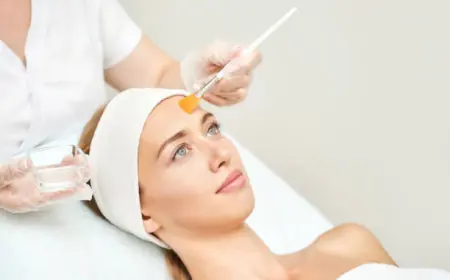 Affordable Chemical Peels in Riyadh: What to Know