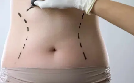 Boost Your Confidence with Lipoabdominoplasty: Here’s How