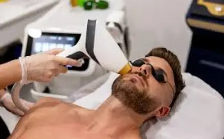 Can Laser Hair Removal Work for Men’s Beard Hair?