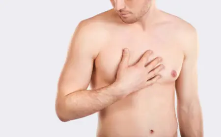 Gynecomastia Surgery in Riyadh: Restoring Confidence and Masculine Contours
