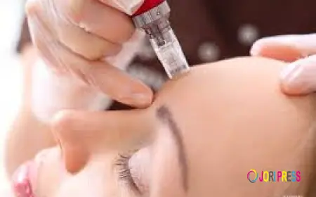 How Laser Treatment Fits into a Full Rosacea Management Plan