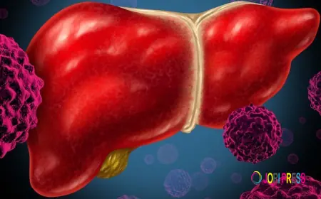 Understanding Immunotherapy for Bone Cancer: A Comprehensive Guide