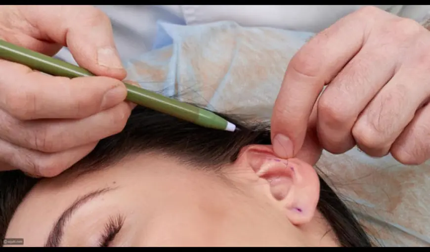 Surgical vs. Non-Surgical Ear Reshaping in Islamabad