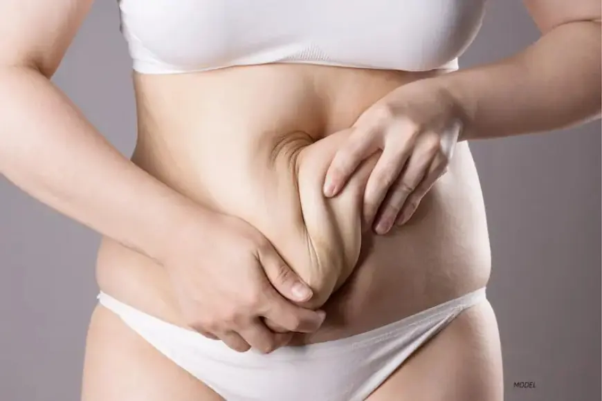 What Tummy Tuck Results Can You Expect Long Term?