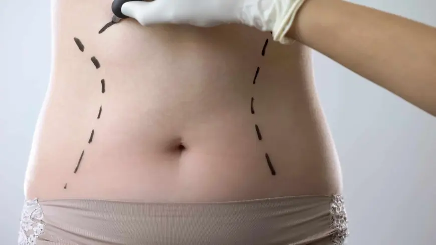 Boost Your Confidence with Lipoabdominoplasty: Here’s How