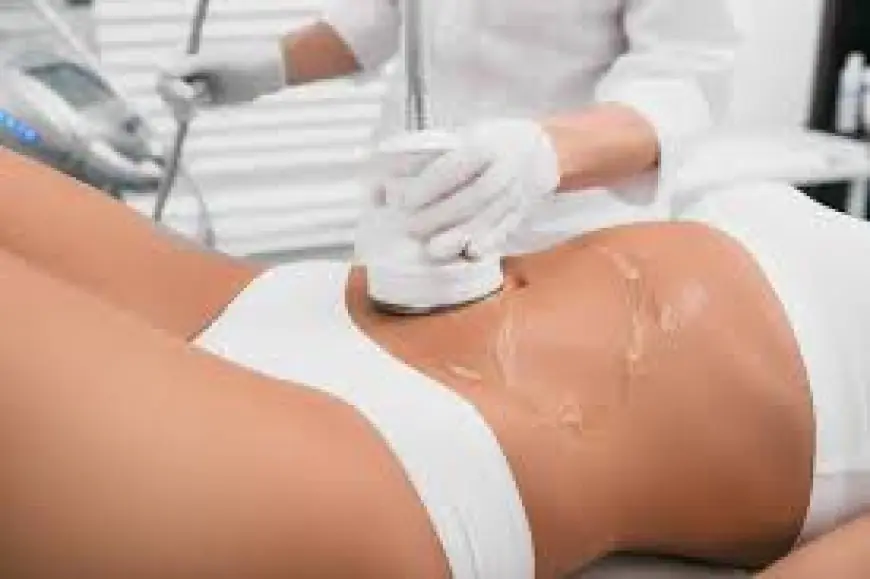 Can laser liposuction permanently remove fat cells from body?