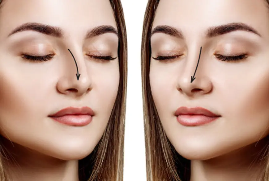 Common Myths About Rhinoplasty in Dubai Debunked