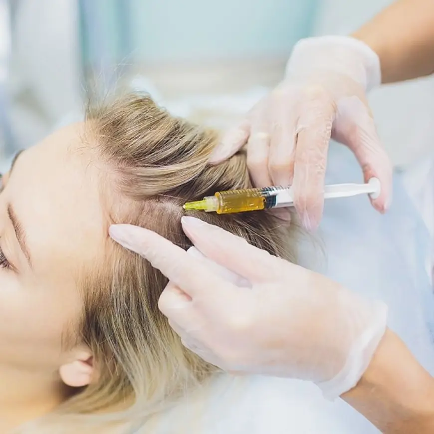 Expert PRP Hair Treatment in Riyadh