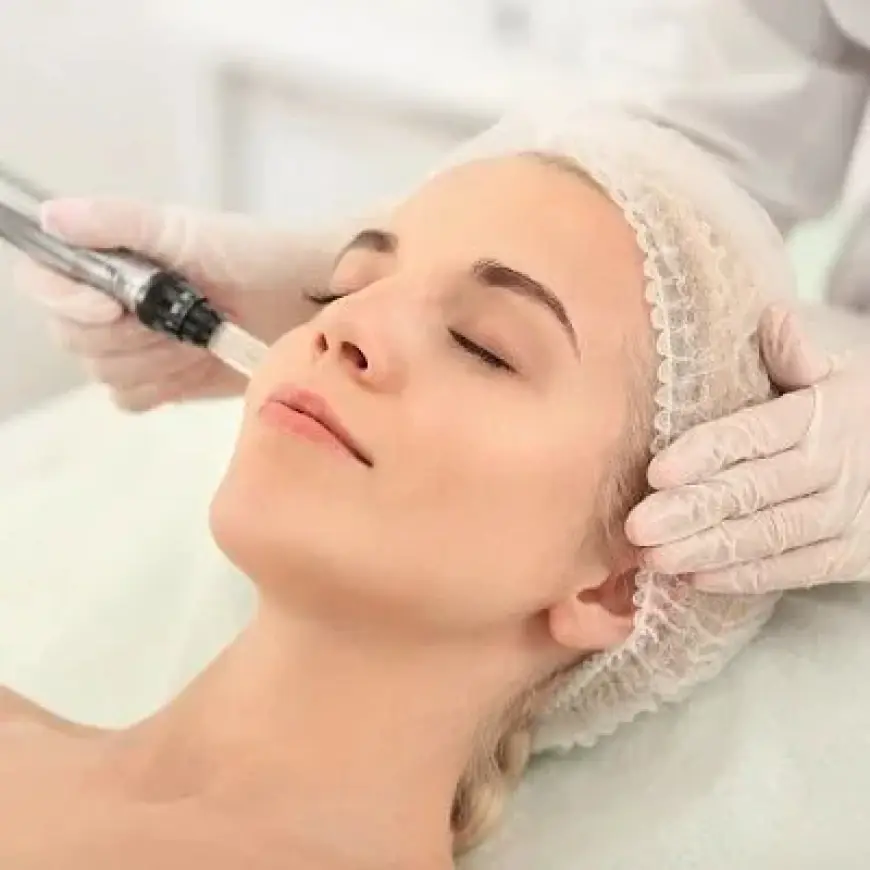 Is Microneedling Good for Oily Skin?