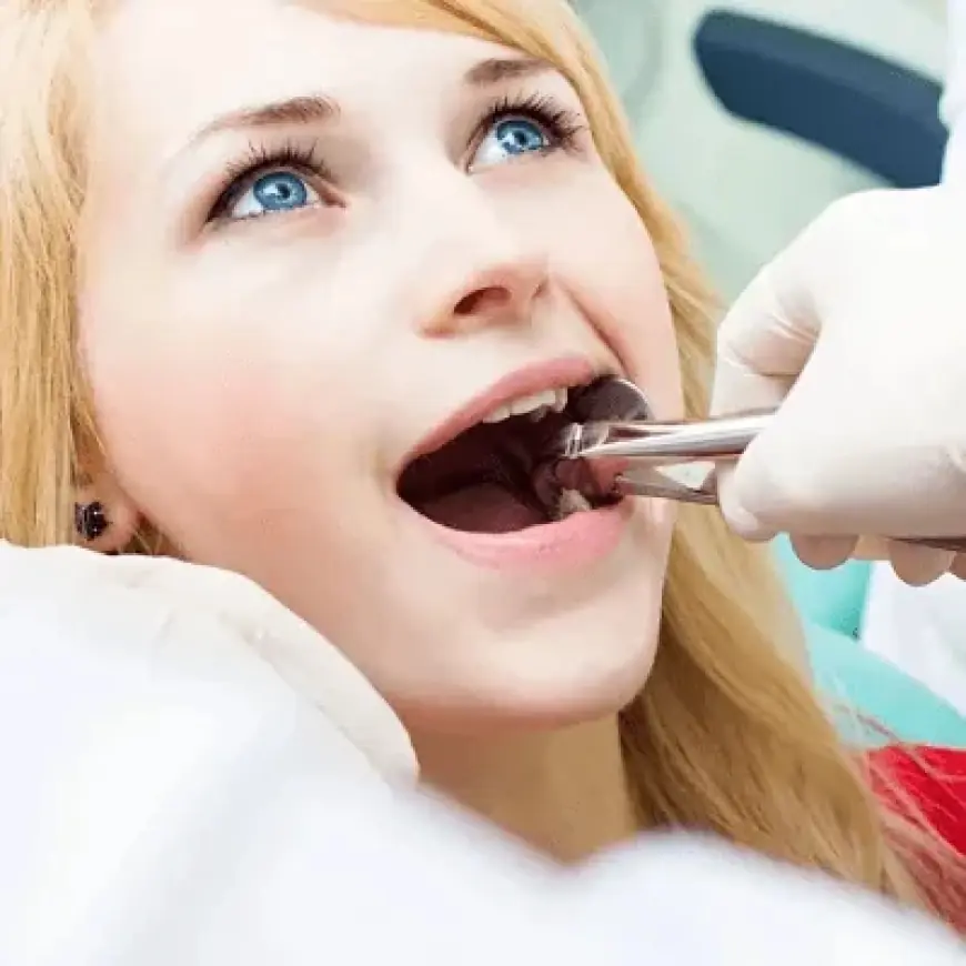 Affordable Surgical Tooth Removal in Islamabad – Expert Care