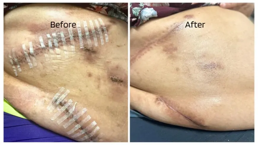 Sensitive Skin Solutions: Steroid-Free Creams for Healing and Daily Care