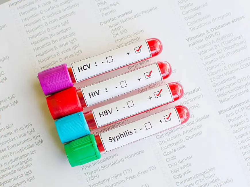 STD Test in Dubai: Cost and Affordable Options You Should Know