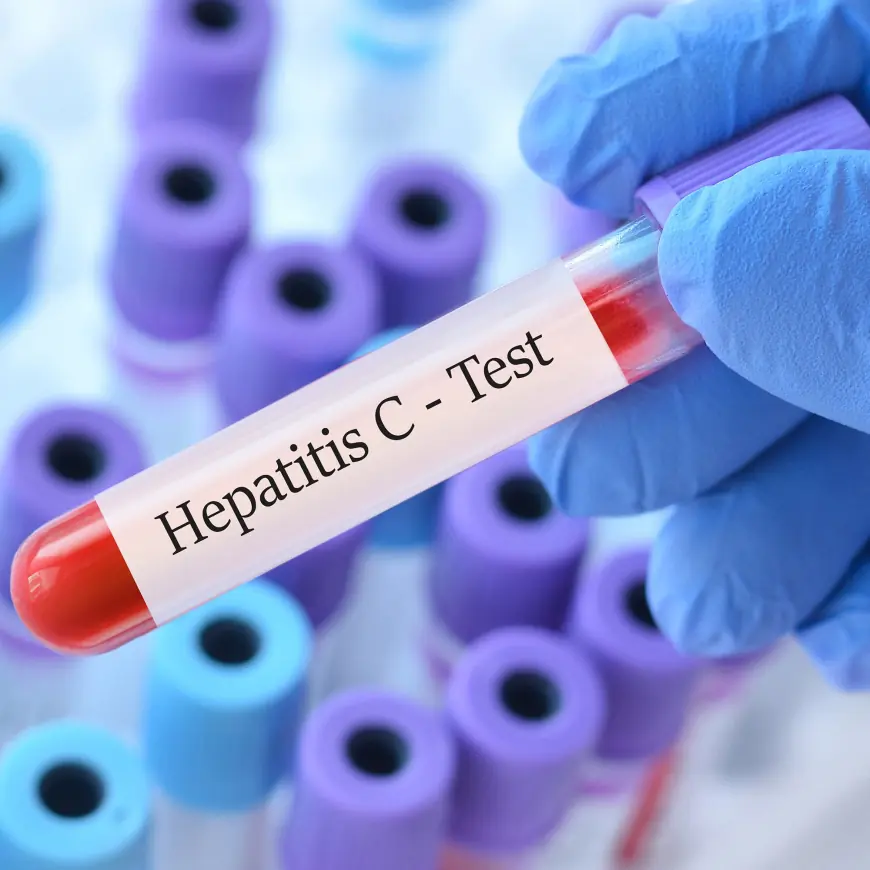 Hepatitis C Test